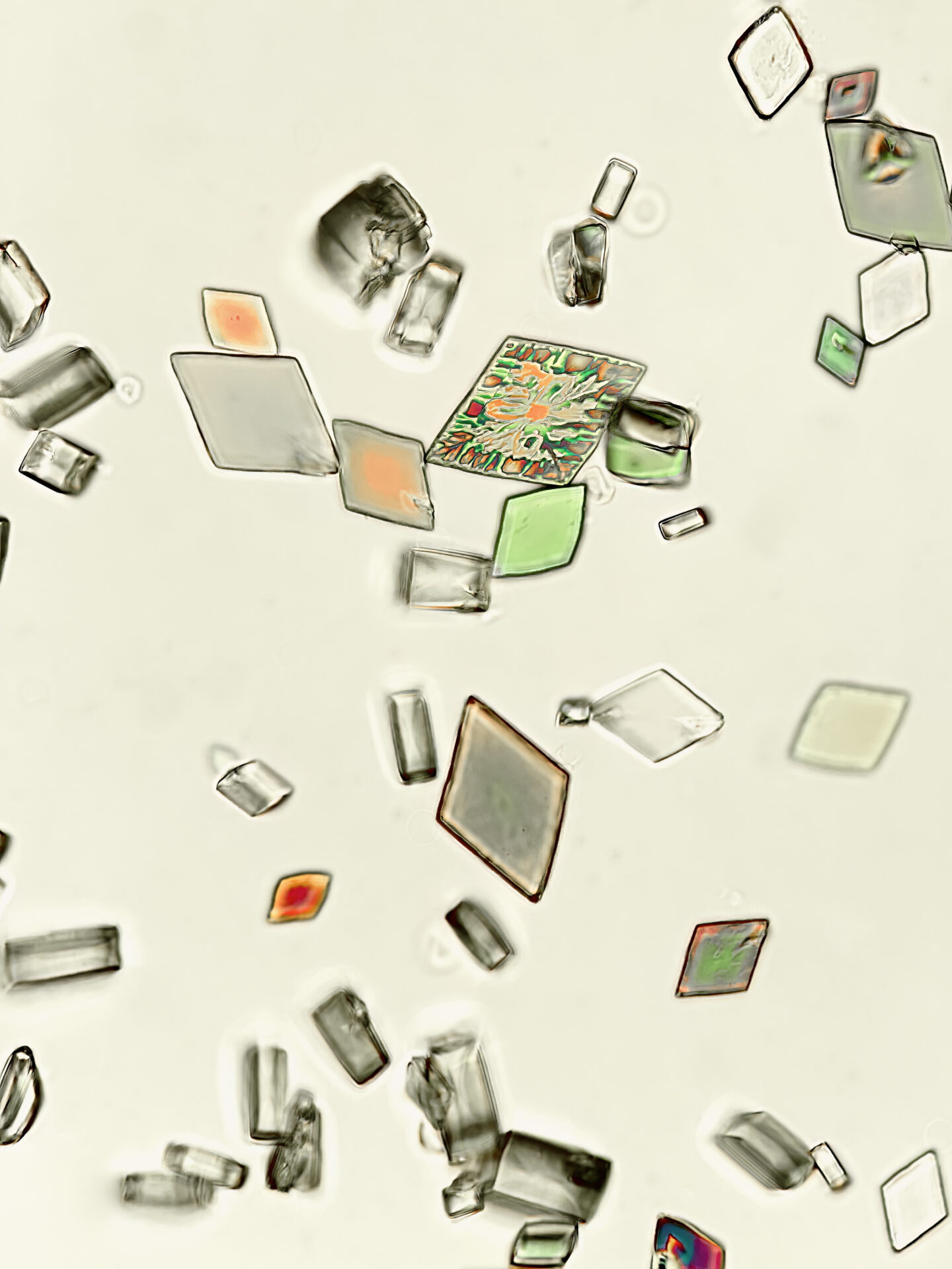 Uric acid crystals, under partial polarization