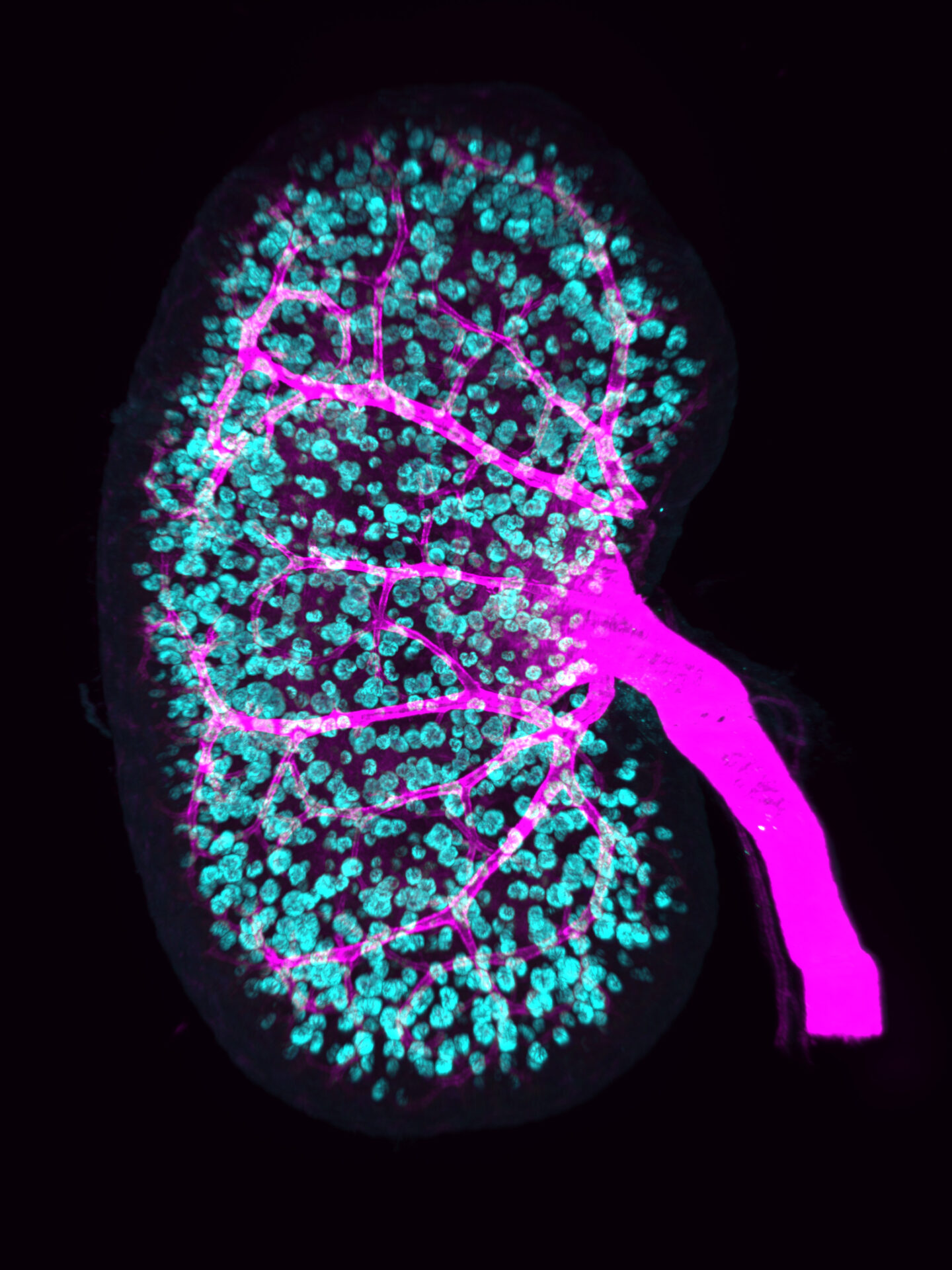 Vasculature (SMA, Magenta) and Glomeruli