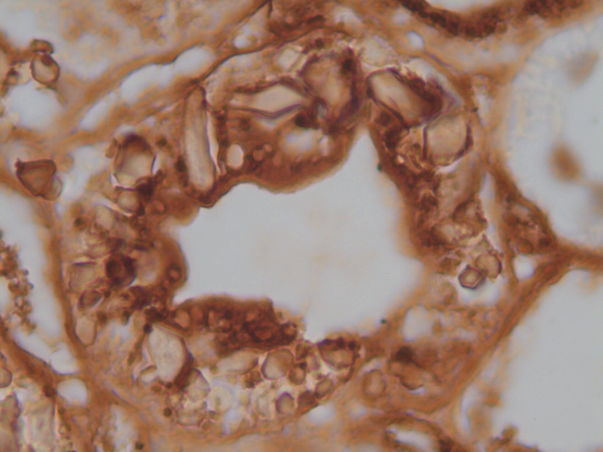 Immunohistochemistry