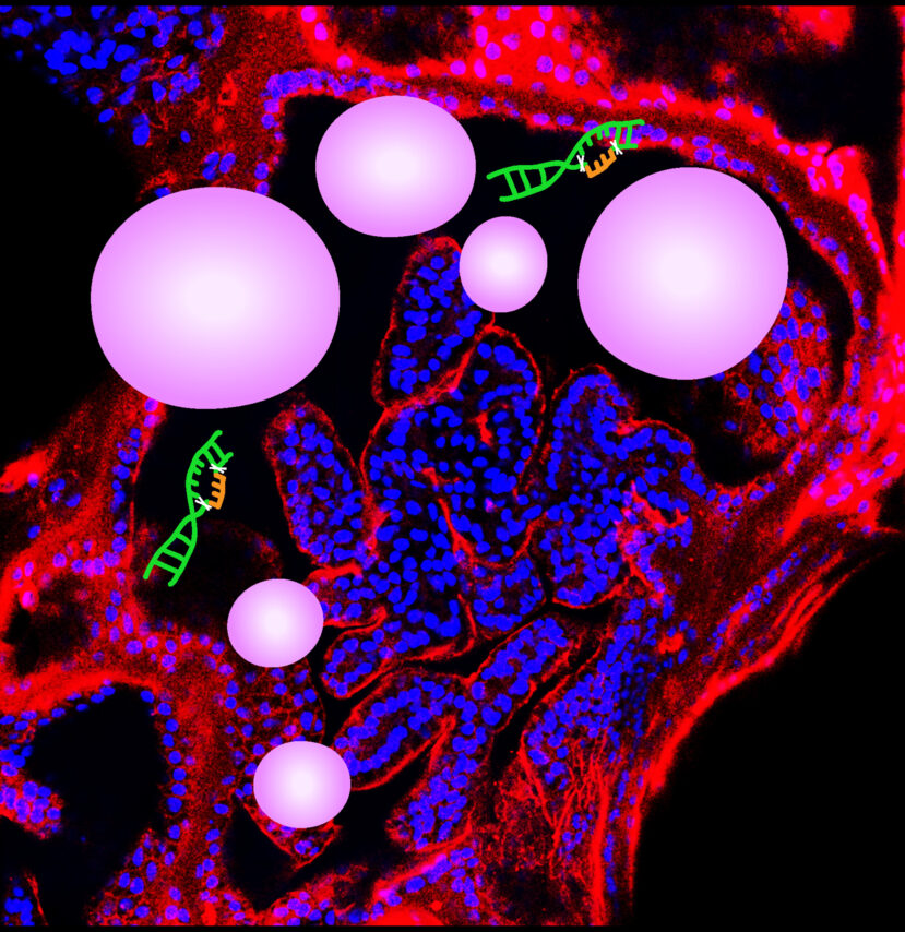 CRISPR-Cas9 gene editing for genetic disease ADPKD