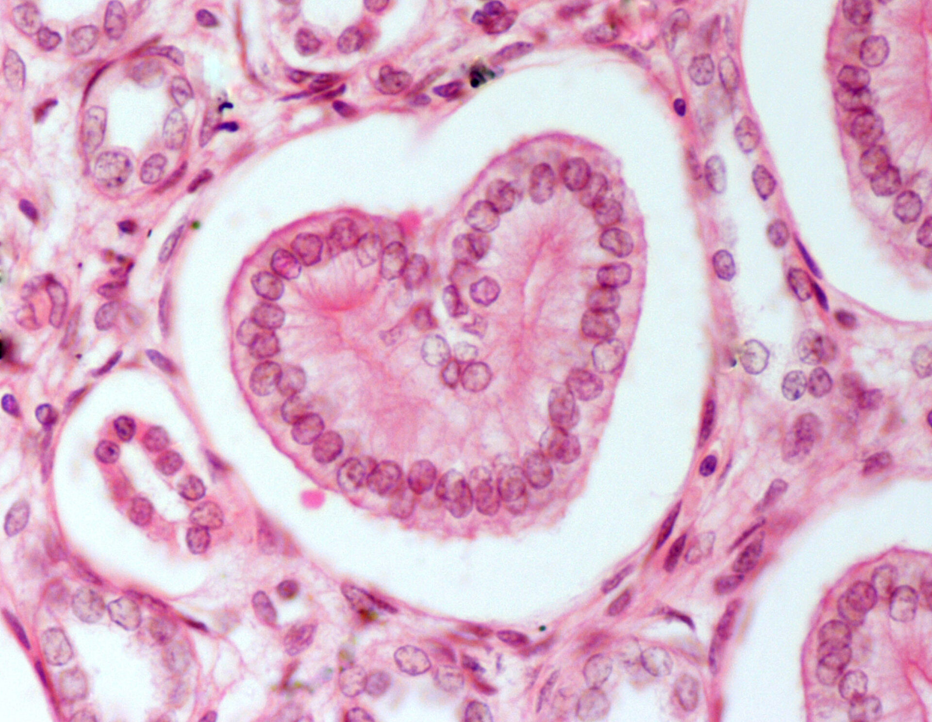 Kidney histological section in which the  “heart” represents collecting tubule